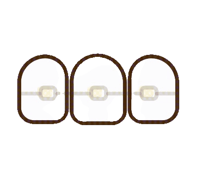 Dental Braces & Aligners