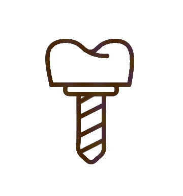 Dental Implants / Teeth Implants