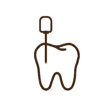 Root Canal Treatment (RCT)